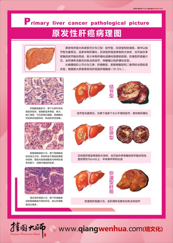 人體肝臟結構 人體肝臟解剖圖譜